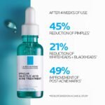 LaRochePosay Effaclar Serum Benefits After Usage