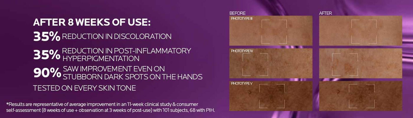 Niacinamide serum usage before and after results