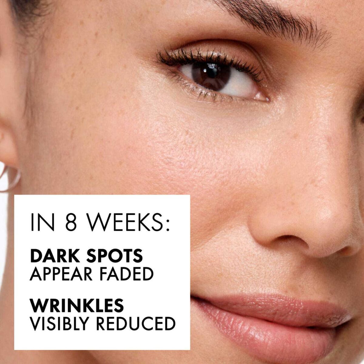 Vichy LiftActiv B3 Serum Benefits