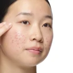 the ordinary aloe 2 nag 2 solution results