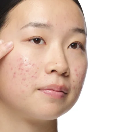 the ordinary aloe 2 nag 2 solution results