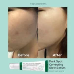 Axis-Y Dark Spot Correcting Glow Serum Before & After Picture