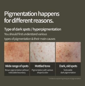 Anua Green Lemon Vita C Blemish Serum - Image 3