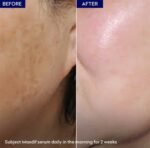 Jenpharm Maxdif Brightening Serum Results