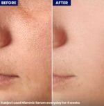 Jenpharm Niaronic Serum Results