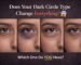 Dark Circles Types Identification