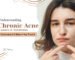 Learn Why Acne Come Back Again